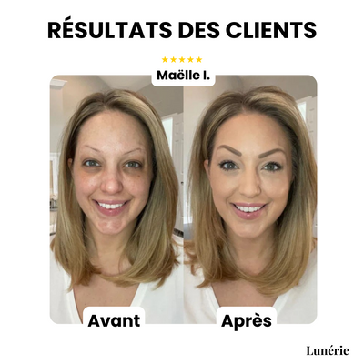 StrahlTeint™ Ebenmäßige Teint-Abdeckung